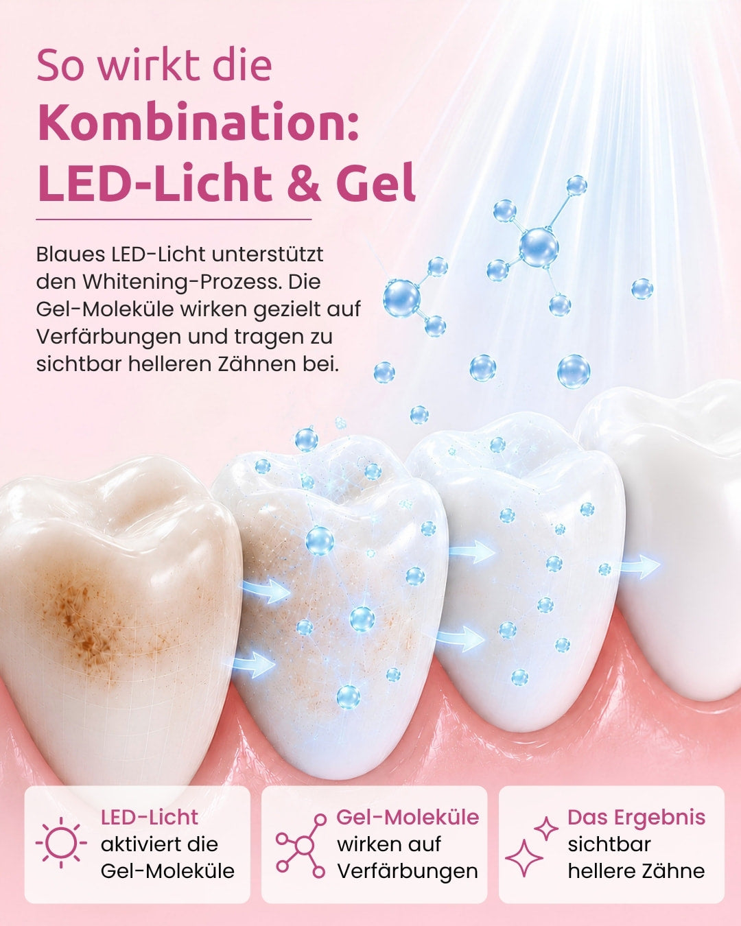 Explicação da combinação de luz LED azul e gel branqueador para dentes visivelmente mais brancos
